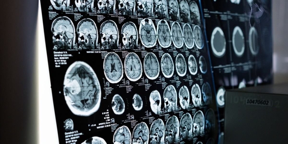 Nurturing Well-being in Our MS Caregiver Community